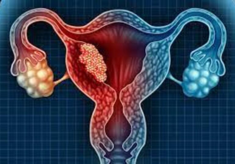 Zdrowie: Badania przesiewowe w kierunku raka szyjki macicy mogą uratować życie wielu kobiet