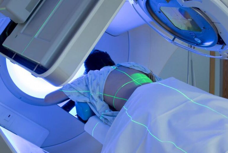 Zdrowie: Czy możliwe jest życie bez bólu po radioterapii?